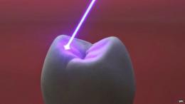 Лазери помагат на увреден зъб да поникне отново